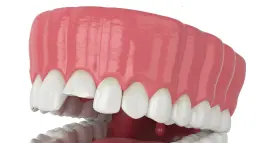 Broken Teeth
