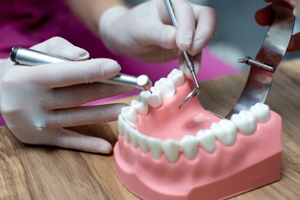 Dental Implant